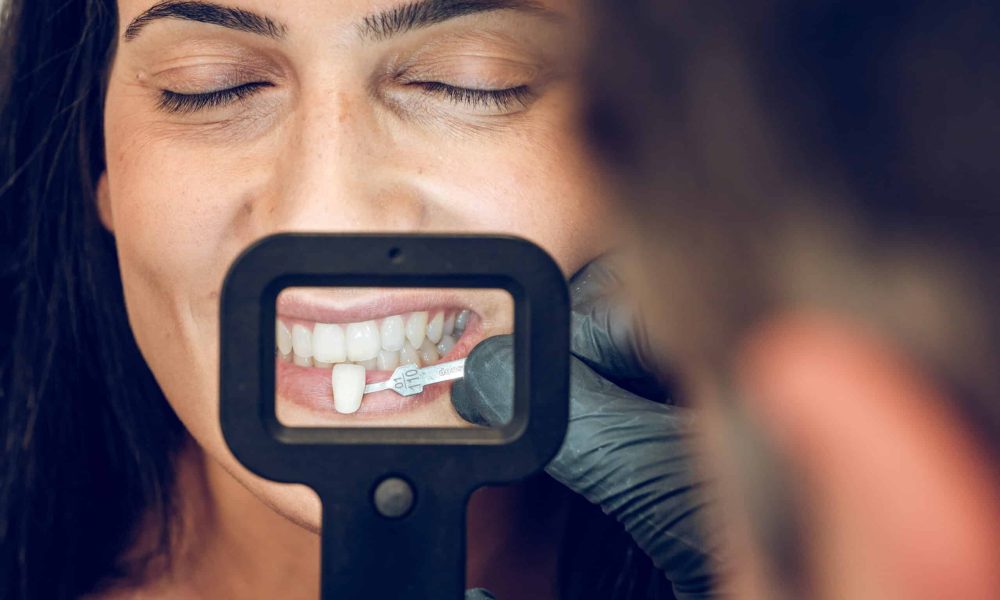 Closeup of men dentist trying on veneer for woman patient using dental mirror and instrument in clinic