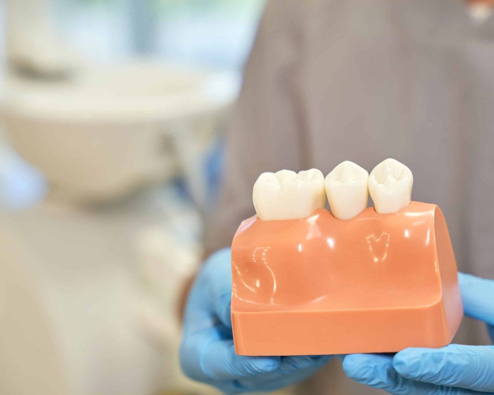 Close-up photo of plastic model of teeth being held by a dental technician in gloves